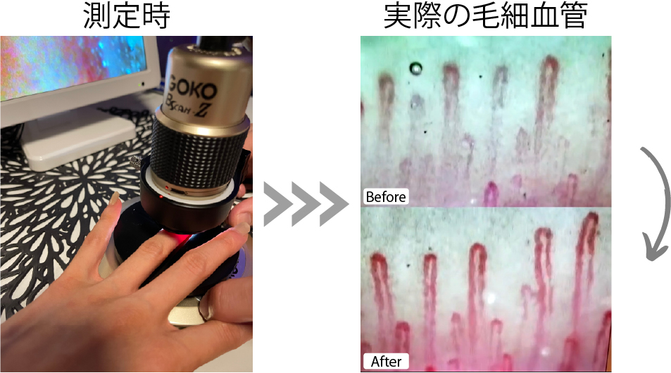 毛細血管測定機